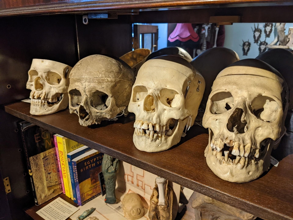 Four human skulls in a cabinet